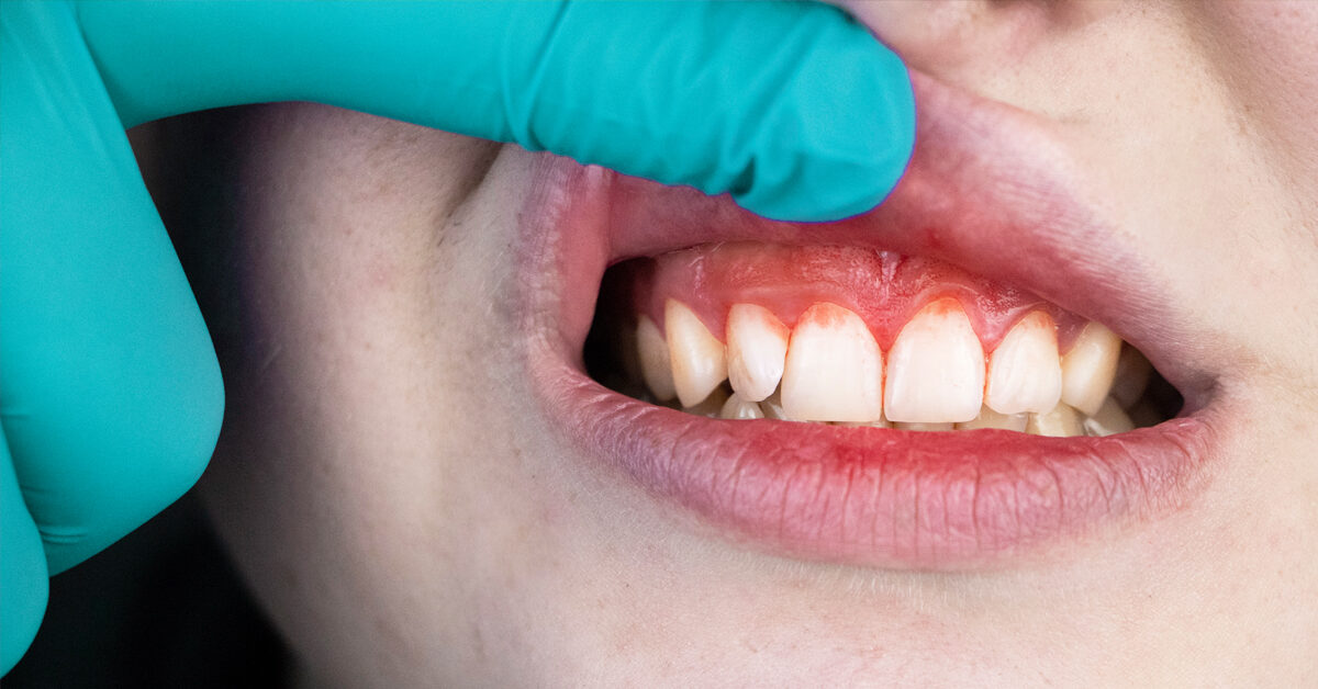Nếu không điều trị kịp thời có nguy hiểm không?