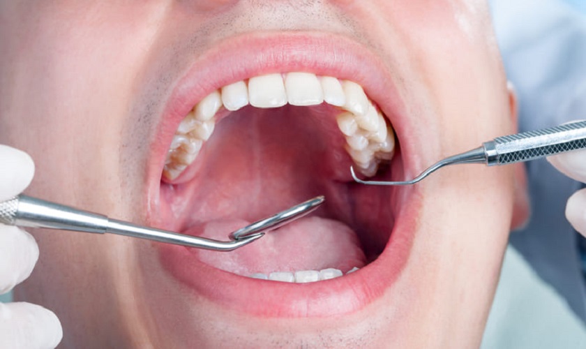 Nhổ răng nào nguy hiểm nhất?