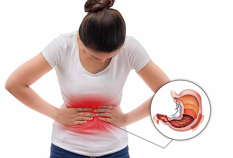 Các bệnh về dạ dày đều khiến lượng axit dịch vị tiết ra tăng cao hơn bình thường dẫn đến đắng miệng