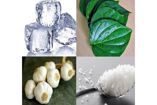 12 cách trị sâu răng vĩnh viễn tại nhà hiệu quả