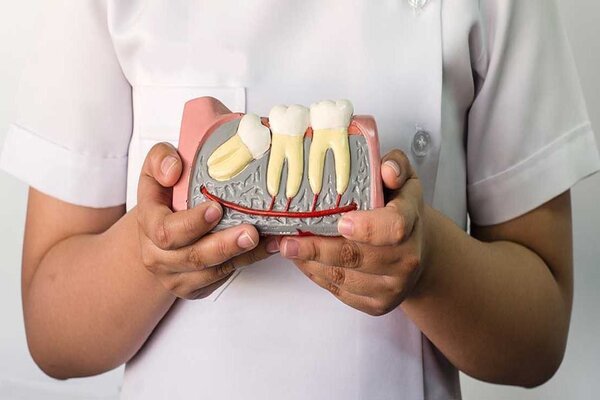 Nếu không nhổ răng không kịp thời có làm sao không?