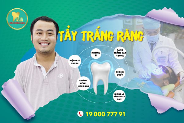 Tẩy trắng răng ố vàng hiệu quả, an toàn nhất