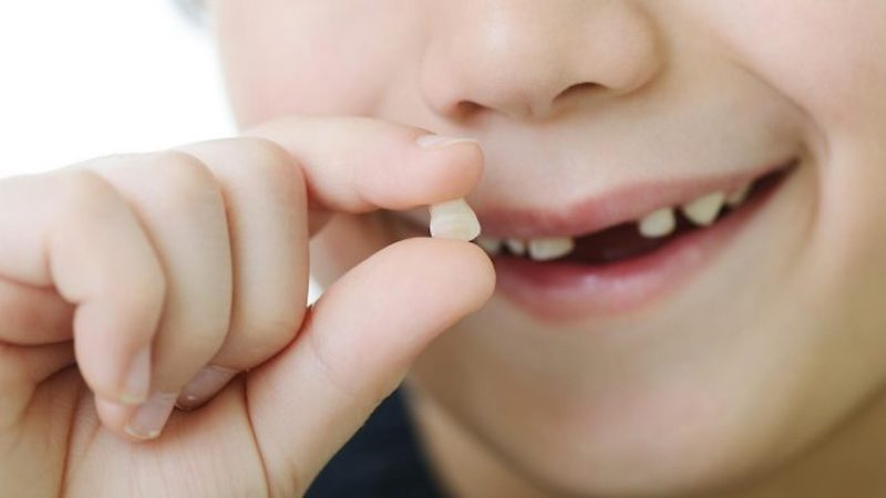 Dấu hiệu răng lung lay là một trong những tình trạng phổ biến mà trẻ nhỏ