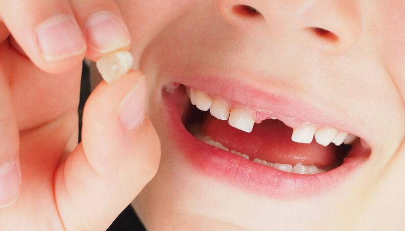 Dụng lưỡi để đẩy các răng lung lay có thể là một phương pháp nhẹ nhàng và không đau